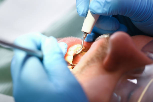 Best Weekend Emergency Dentist in Bellaire, TX
