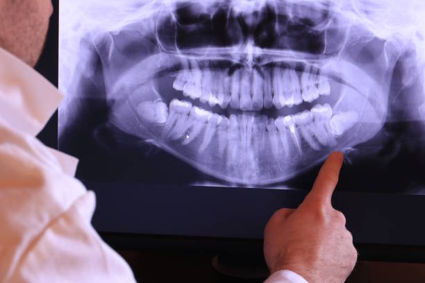 Best Urgent Care for Lost Fillings or Crowns in Bellaire, TX