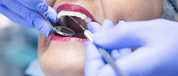 Best Emergency Gum Treatment in Bellaire, TX